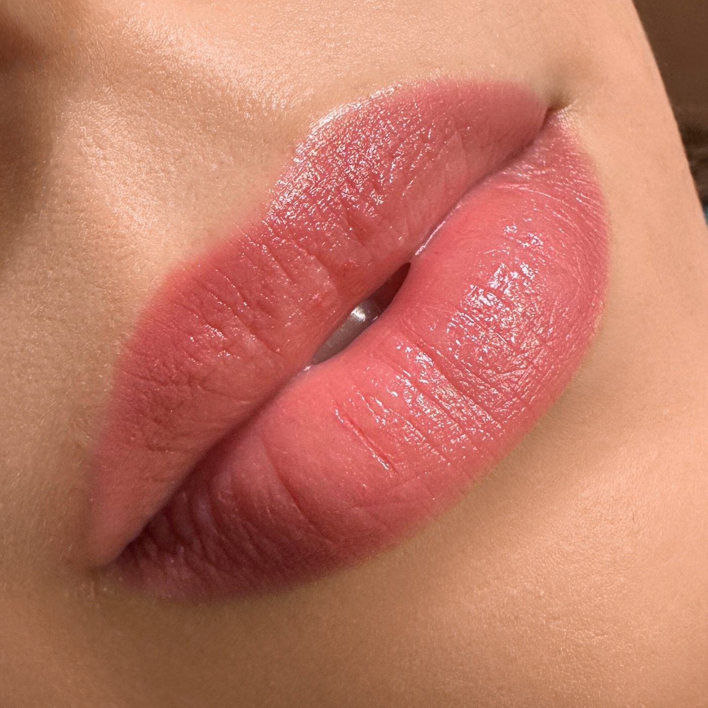 Candy Lips, abgeheilt