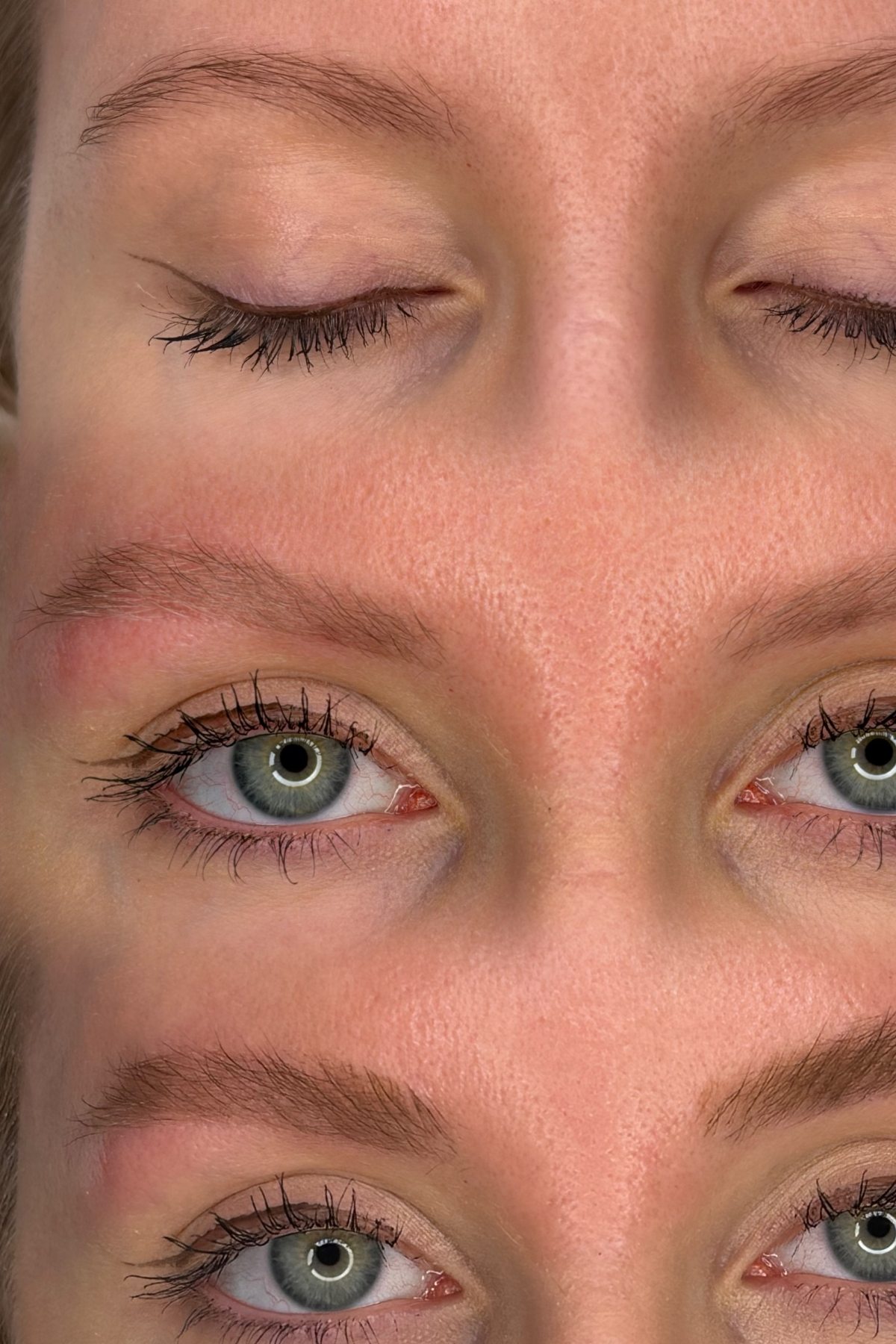 Vorher, abgeheilt, und abgeheilt mit Stylinggel