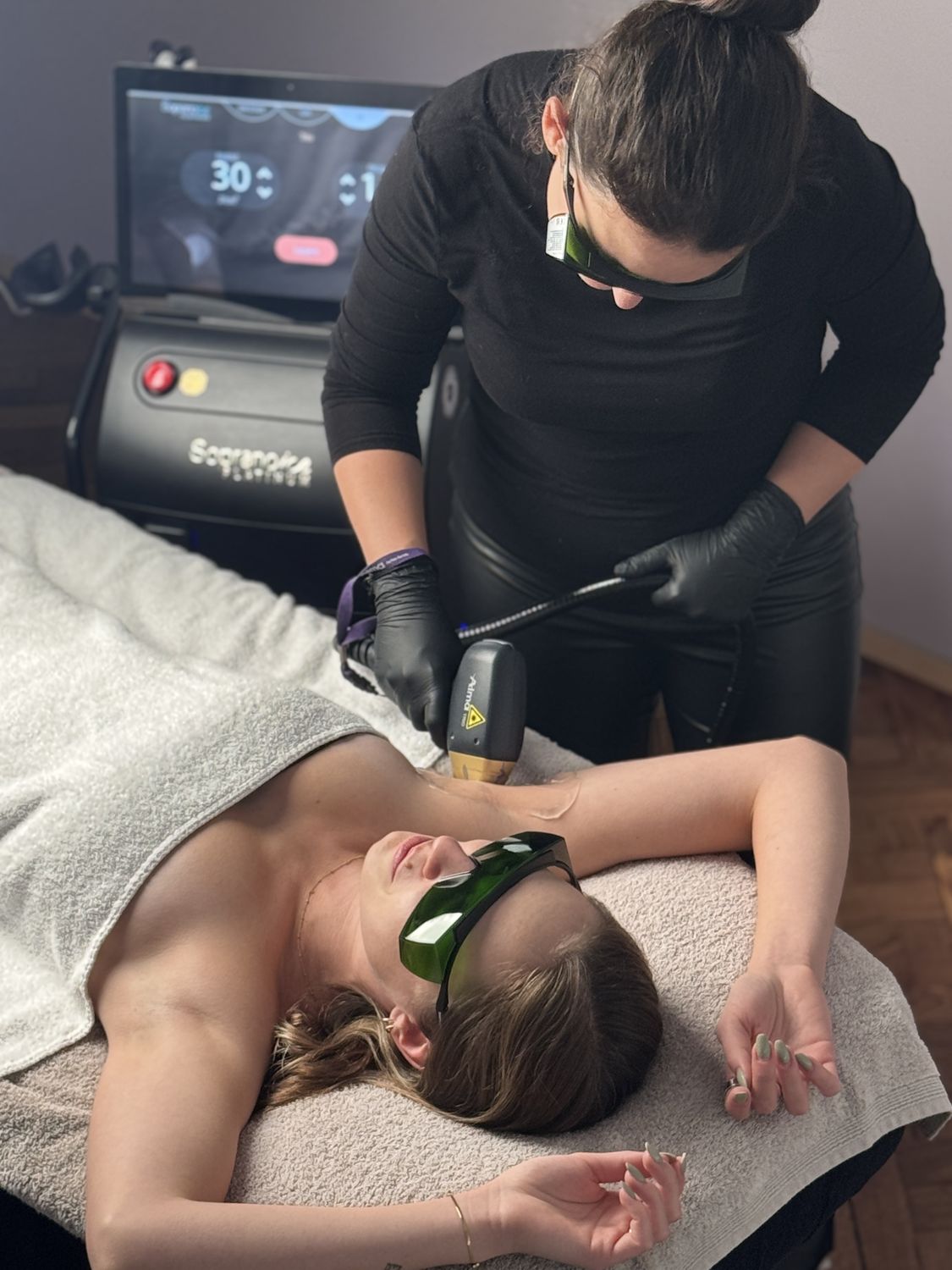 Laserhaarentfernung mit dem Soprano ICE Platinum