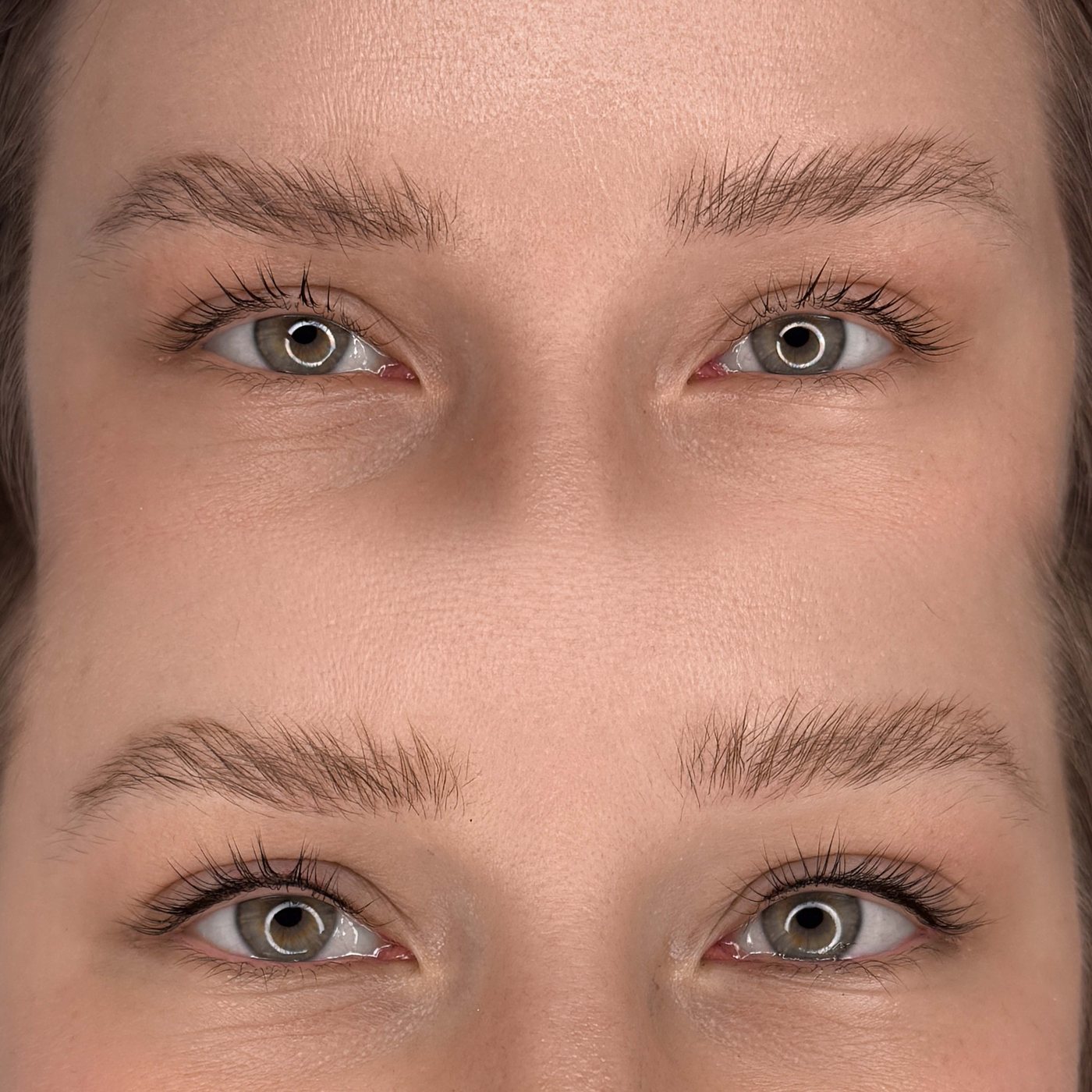 Wimpernkranzverdichtung, vorher und nachher